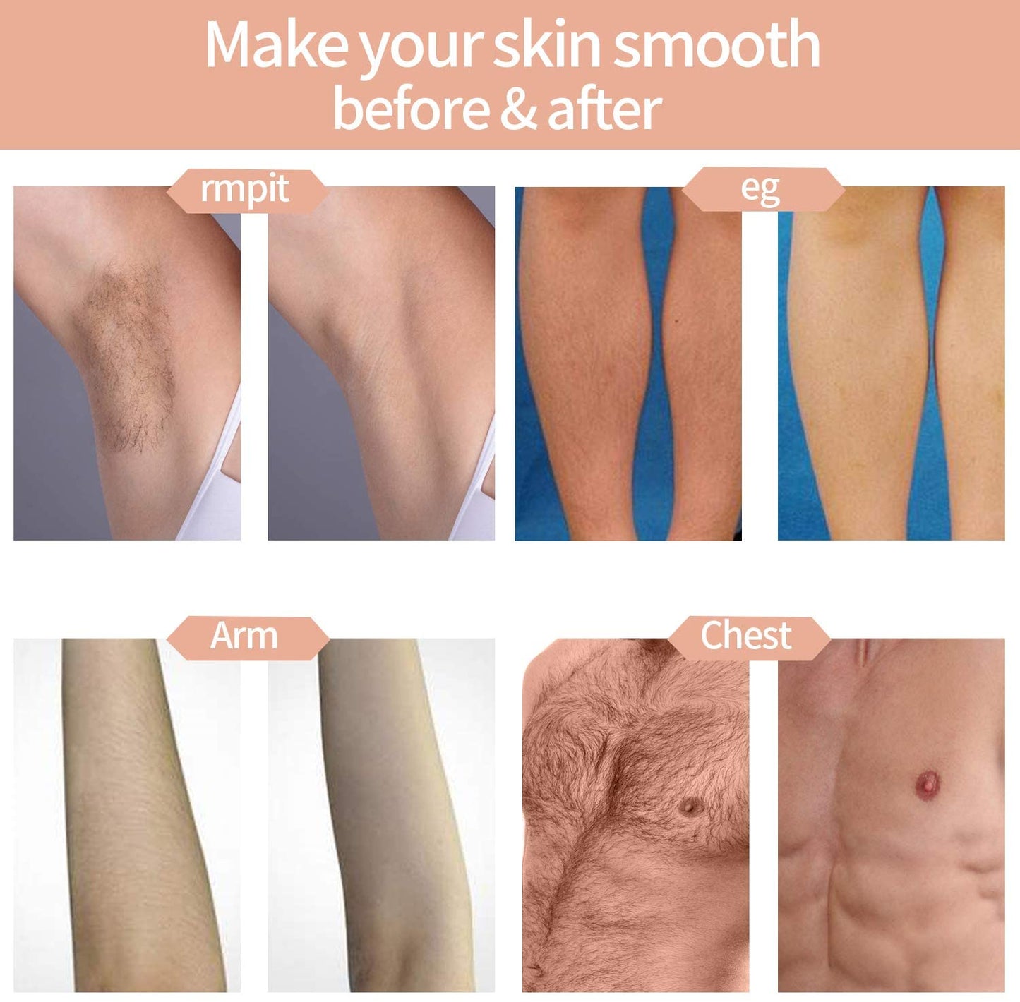 Body Hair Removal Device, Permanent Hair Reduction, IPL Beauty Device