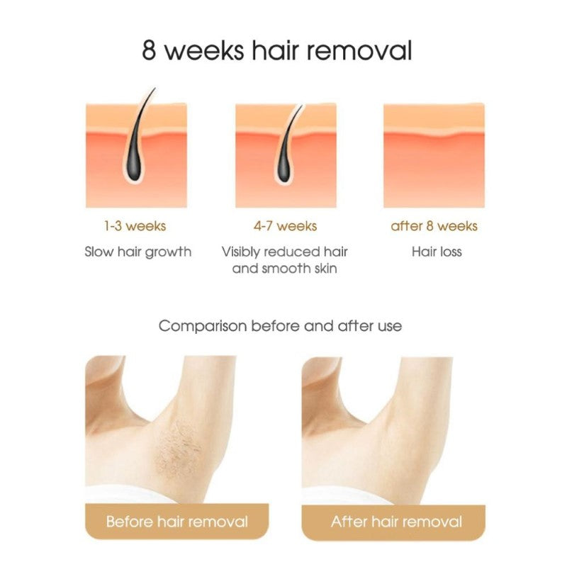 IPL Hair Removal Device 5-Gear IPL Hair Removal Device for Body