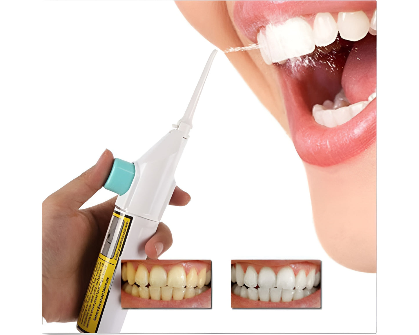 Water Flosser Portable - Power Floss Dental Water Flosser for Braces & No-Battery Use
