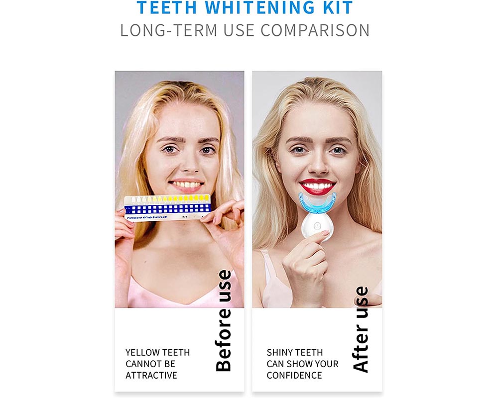 SMILEKIT Teeth Whitening Kit with 16 LED Accelerator Light