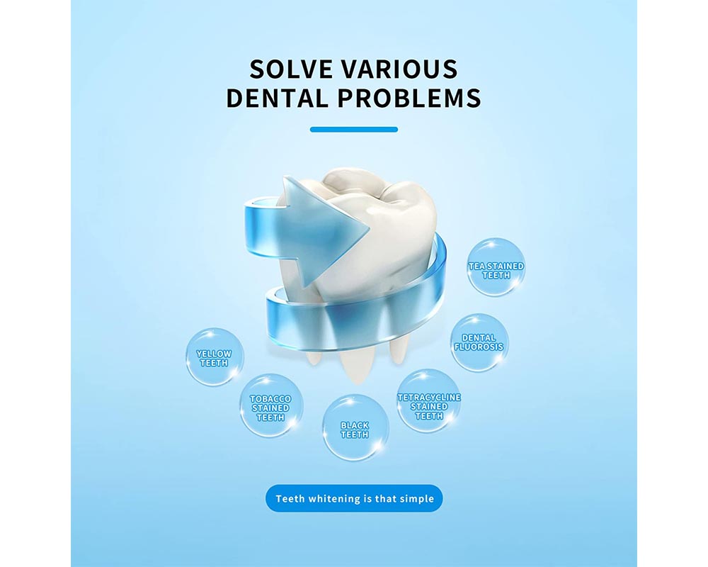 SMILEKIT Teeth Whitening Kit with 16 LED Accelerator Light