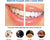 Teeth Whitening Strips, 9D Teeth Whitening Strips, Professional Teeth Whitener and Teeth Whitening Kit, Safe Formula for Sensitive Teeth Teeth Whitening Kit
