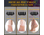 Electric Callus Remover