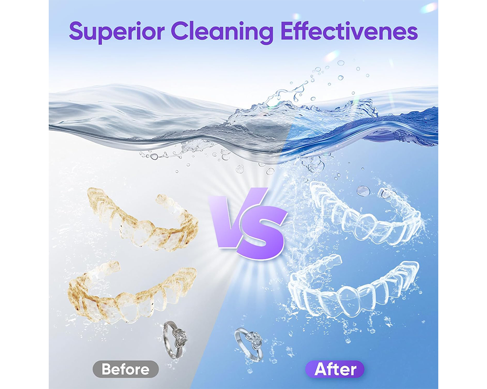 Dental Ultrasonic Retainer Cleaner Machine