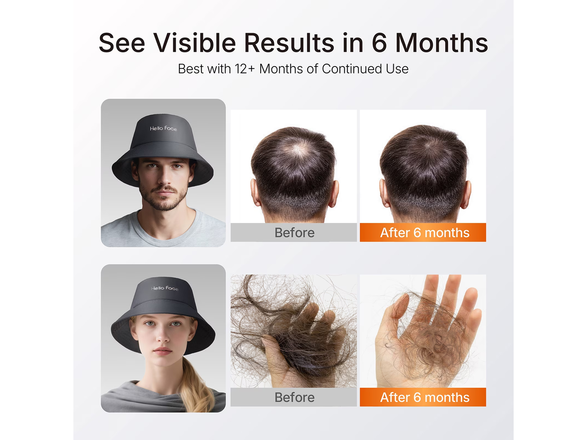 Red Light Therapy Hair Growth Cap 336 LED