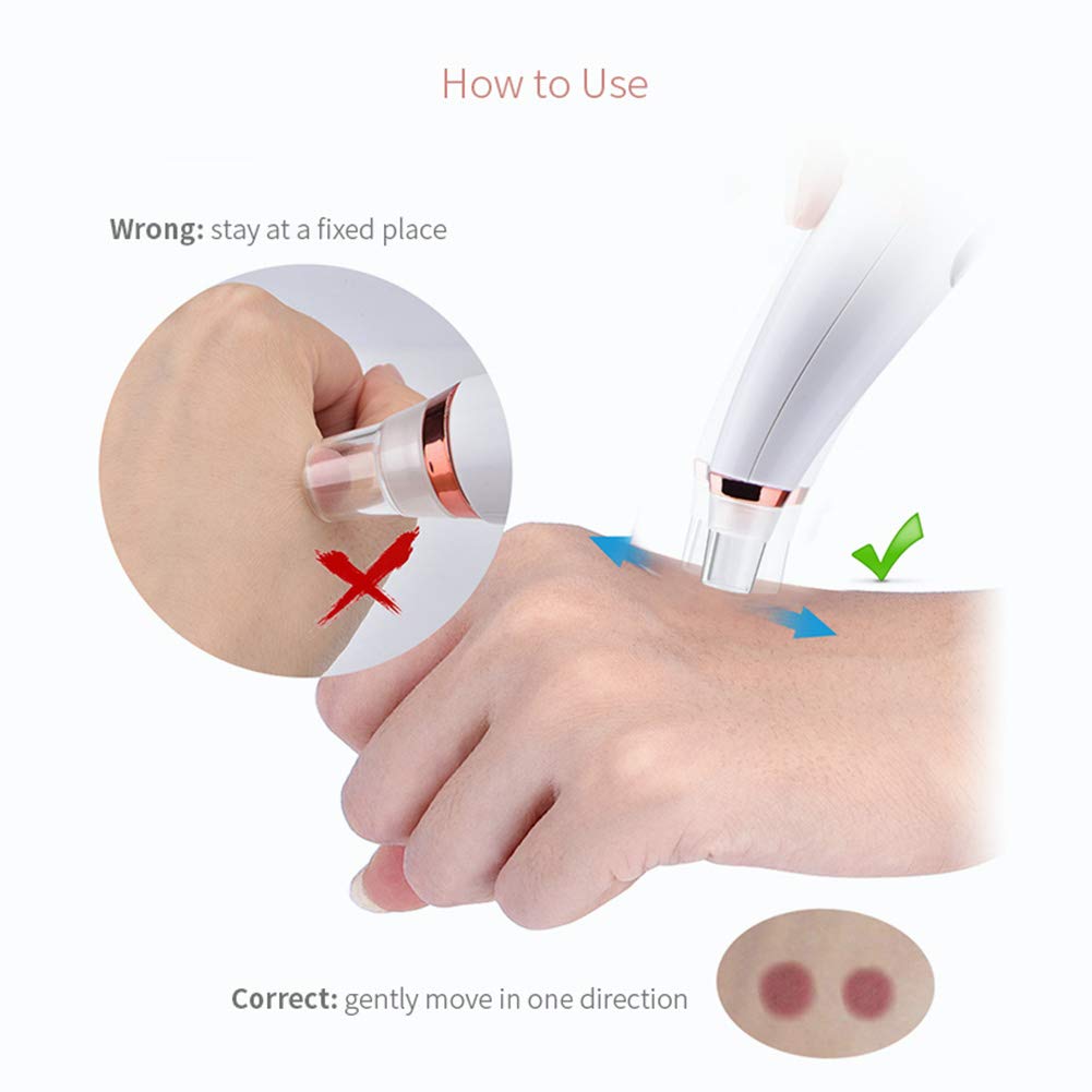 Black head remover Face Pore Vacuum Cleaner Blackhead Vacuum