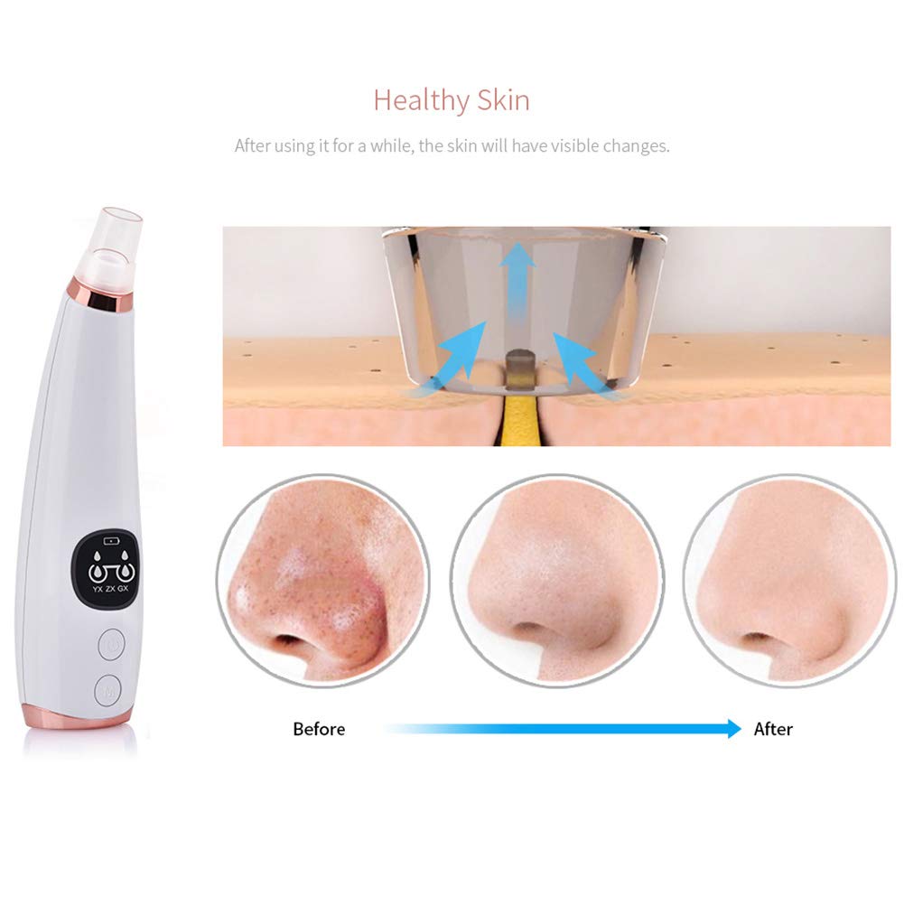 Black head remover Face Pore Vacuum Cleaner Blackhead Vacuum